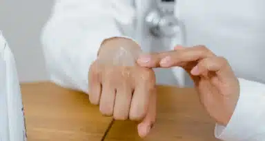 Une dermatologue qui étale de la crème sur sa main